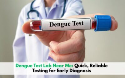 Dengue Test Lab Near Me: Quick, Reliable Testing for Early Diagnosis